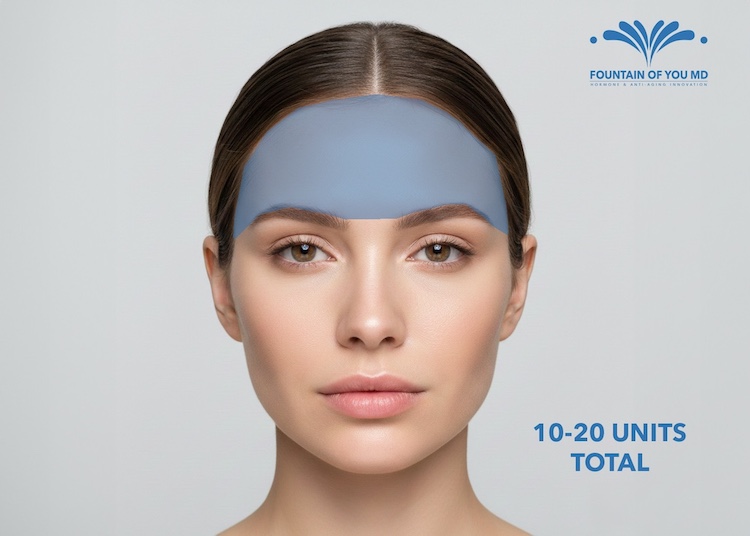 Injection sites and number of units of Botox for the forehead from Fountain of You MD