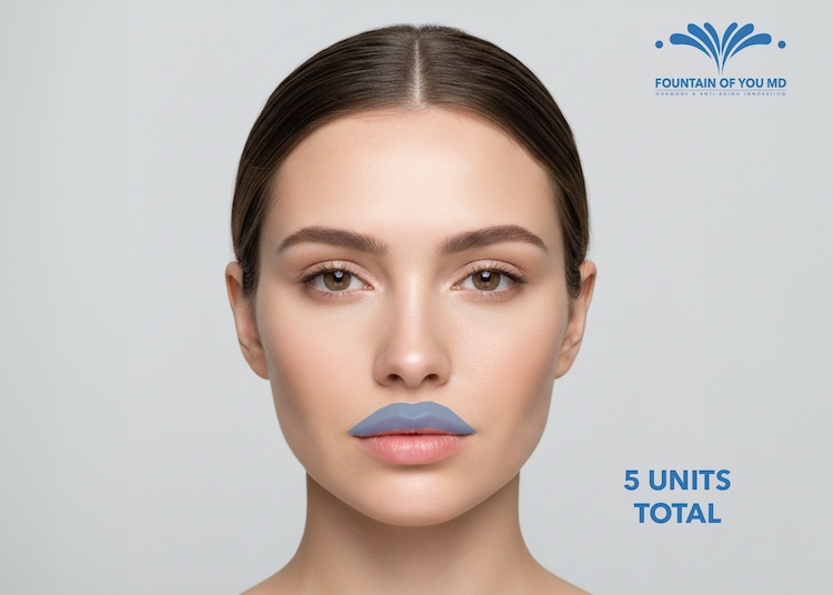 Injection sites and number of units of Botox for a lip fliip from Fountain of You MD