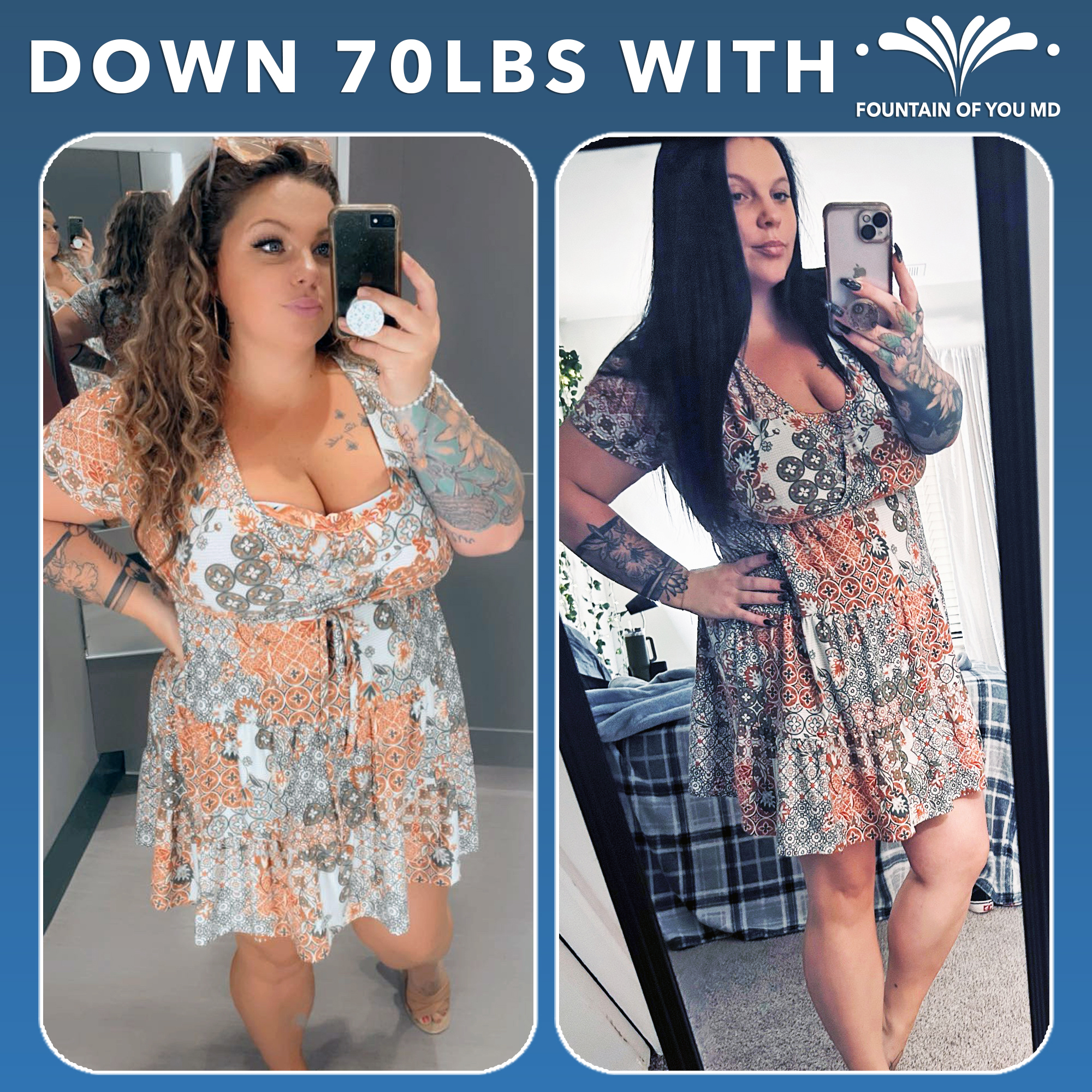Before and After Weight Loss at Fountain of You MD